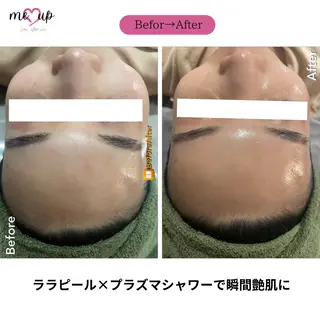 Meupニキビ専門店 背中/ハーブ/肌管理のその他イメージ