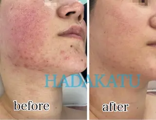 総合エステサロン 肌活のエステ・リラクイメージ