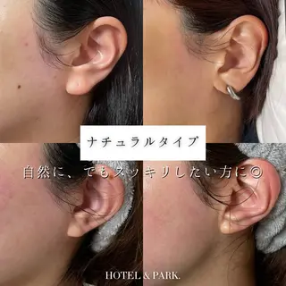 HOTEL&PARK . ワックス脱毛のエステ・リラクイメージ