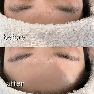 アイブロウ UN・MULAN (大田　瑶子)のエステ・リラクイメージ