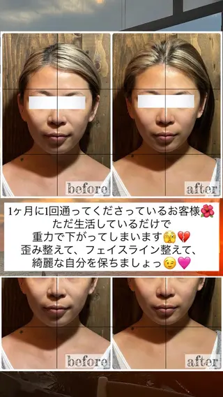 💎後悔させない小顔 矯正💎イトヤマ🌱のエステ・リラクイメージ