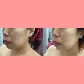 美肌専門サロン RUBONのエステ・リラクイメージ