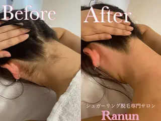 マツエク・マツパ シュガーリング脱毛 専門店Ranunのエステ・リラクイメージ