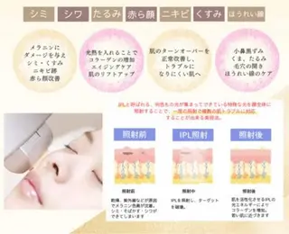 salonvilla所属・villa ☺︎草山 楓花のエステ・リラクイメージ