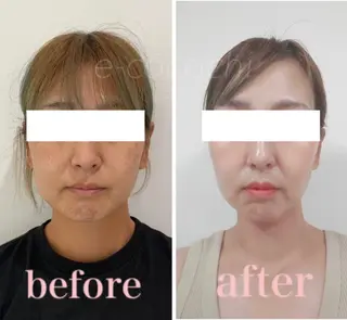 小顔と ヘッドスパのお店のエステ・リラクイメージ