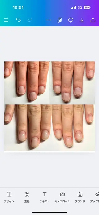 ネイル 深爪矯正専門店ネイルサロンKUU所属・深爪矯正専門店 ネイルサロンKUUのネイルデザイン