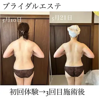 I'm -イム-所属・肌質改善/ブライダル I'm.-イム-のエステ・リラクイメージ