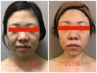 美ola ビオラのエステ・リラクイメージ