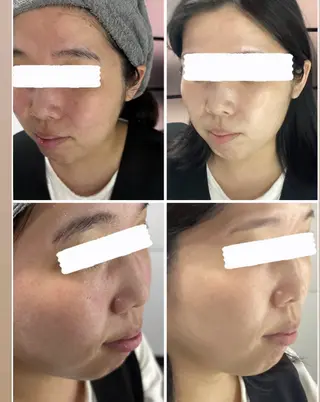 肌質改善サロン🌕 ⠀【ルーナピエナ】のエステ・リラクイメージ