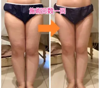 ロング カラー パーマ ヘアアレンジ メンズ キッズ ネイル マツエク・マツパ ‍痩身＆ボディ 結果出し🌟丹野のエステ・リラクイメージ