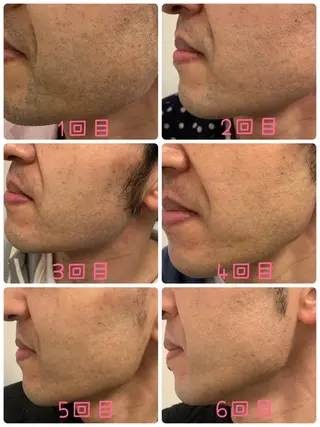 メンズ Mens Salon SOLEのエステ・リラクイメージ