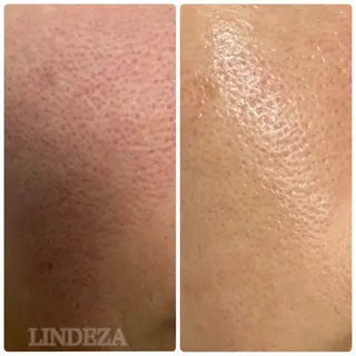 private salon 𝐋𝐈𝐍𝐃𝐄𝐙𝐀所属・LINDEZA Ayaのエステ・リラクイメージ