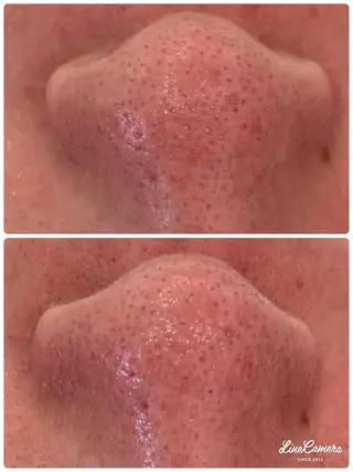 フェイシャルワックス 自然派エステファーノのその他イメージ