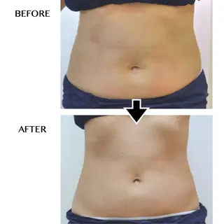 バストアップ・痩身 脱毛/🌺ｺｵﾘﾅのエステ・リラクイメージ