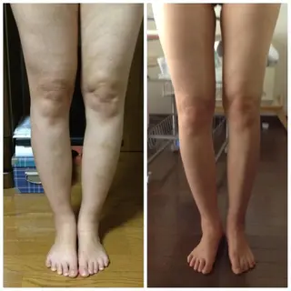 ESPOIR エスポワールのエステ・リラクイメージ