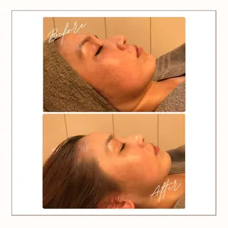 小顔×肌質改善サロン soin〔ソワン〕のエステ・リラクイメージ