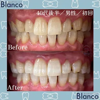 メンズ Blanco川口駅前店所属・Blanco 川口駅前店のその他イメージ