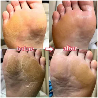 巻き爪補正店　柏店所属・巻き爪補正店 柏店のその他イメージ