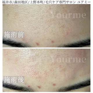 毛穴肌質ケアサロン Yourmeユアミーのエステ・リラクイメージ