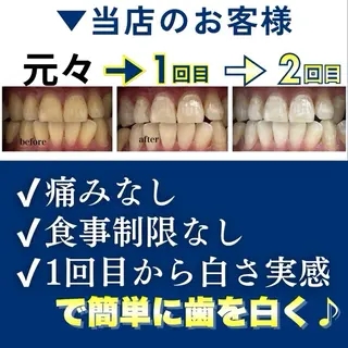 メンズ ホワイトニング 国内最大級|枚方市のエステ・リラクイメージ