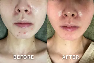 韓国美肌/肌質改善 【天神】yuiのエステ・リラクイメージ