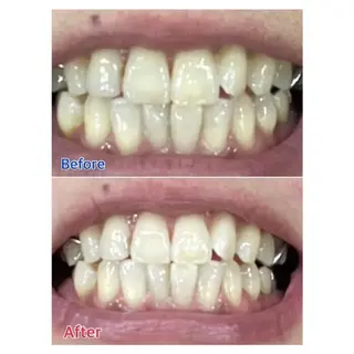 M渋谷店所属・Ｍ渋谷 ホワイトニングのその他イメージ