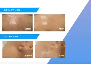 レティティア【Laetitia】所属・レティティア秋葉原店 Yoshizawaのエステ・リラクイメージ