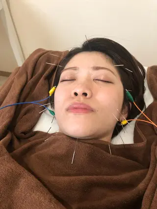 SBHメディカル美容サロン所属・🐱美容鍼・整体 SBHメディカル👍のエステ・リラクイメージ