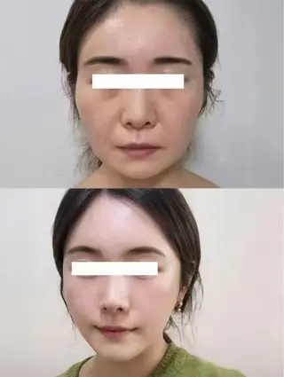 マツエク・マツパ 愛維美水光美肌専門店所属・愛維美水光美肌専門店 メンズレディースokのエステ・リラクイメージ