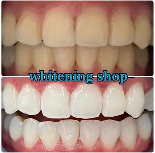 ホワイトニング ショップ吉祥寺店のエステ・リラクイメージ