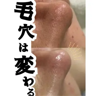 aroma  YURARI所属・韓国艶美人// 毛穴ケア🌹のエステ・リラクイメージ