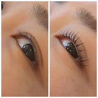 マツエク・マツパ 結果が出るスキンケア 肌質改善/まつパのエステ・リラクイメージ