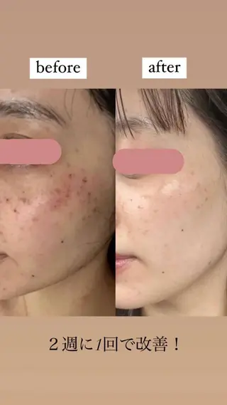 km retreat mentのエステ・リラクイメージ