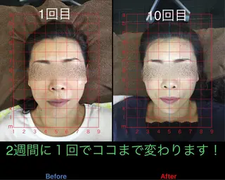 小顔矯正/美容整体 /骨盤矯正✨+Mi2のエステ・リラクイメージ
