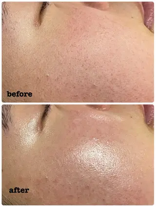 肌質改善専門店/絹々(きぬ)所属・心満たされる ハーブピーリング絹々のエステ・リラクイメージ