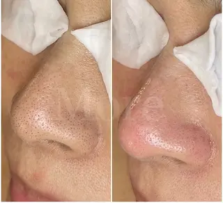 salon de beauté More所属・More 大阪福島区 毛穴・肌質改善のエステ・リラクイメージ