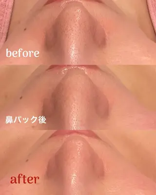 ファッショニスタ risaのエステ・リラクイメージ