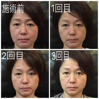 マナビス& ボワールのネイルデザイン