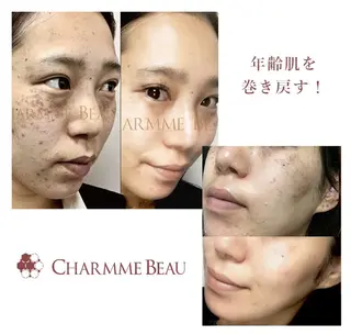 肌質改善サロン renew所属・肌質改善サロン renew/ｳｴｷのエステ・リラクイメージ