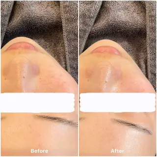 ✨韓国肌管理✨ Lisaのエステ・リラクイメージ