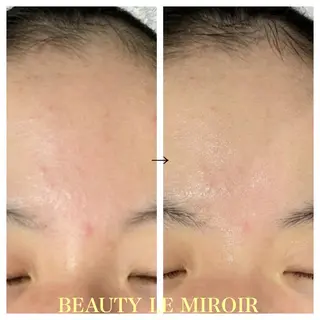 ビューティー ミロワールのエステ・リラクイメージ