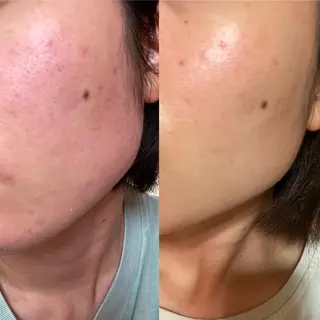 素肌キレイLab.所属・≪ニキビケア≫ 素肌キレイLab.のエステ・リラクイメージ