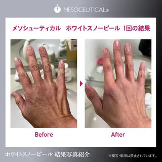 Salon de cheri サロンドシェリ人形町店所属・毛穴のお悩み・シミ 松本瞳のエステ・リラクイメージ