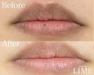 ハーブピーリング LIME池袋東口のエステ・リラクイメージ