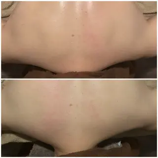 PIUMA 筋膜リリース・リンパのエステ・リラクイメージ