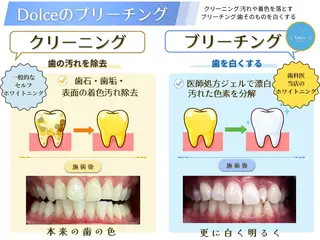 セルフホワイトニング Dolce八王子店のその他イメージ