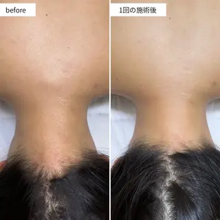 なにわのシミ取り職人 YUKIのエステ・リラクイメージ