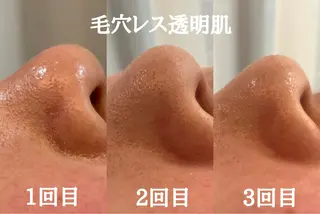 最速小顔・肌質管理 espoirマキのエステ・リラクイメージ