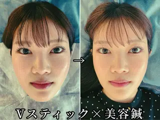 渋谷 小顔美容鍼 専門サロン YZのエステ・リラクイメージ