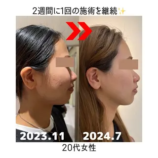 R-four🦋 土屋のエステ・リラクイメージ